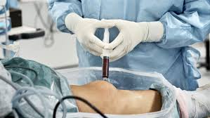 Anestezi ve Rejeneratif Tıp